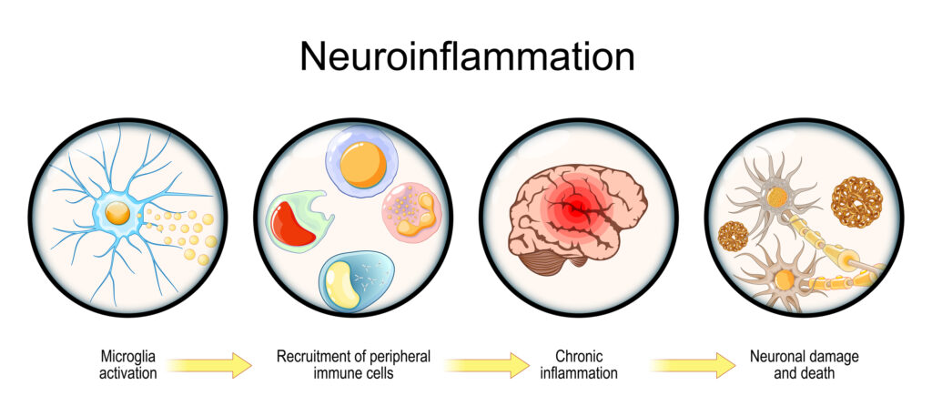 diagram of neuroinflammation